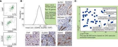 Uncovering a Distinct Gene Signature in Endothelial Cells Associated With Contrast Enhancement in Glioblastoma